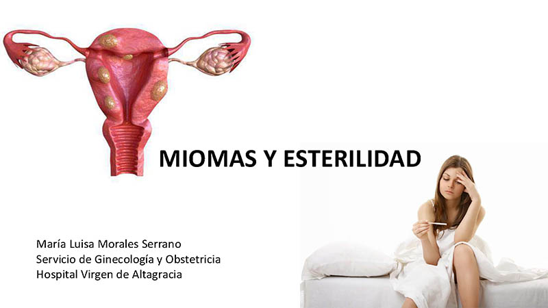 MIOMAS y ESTERILIDAD