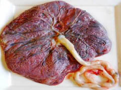 placenta
