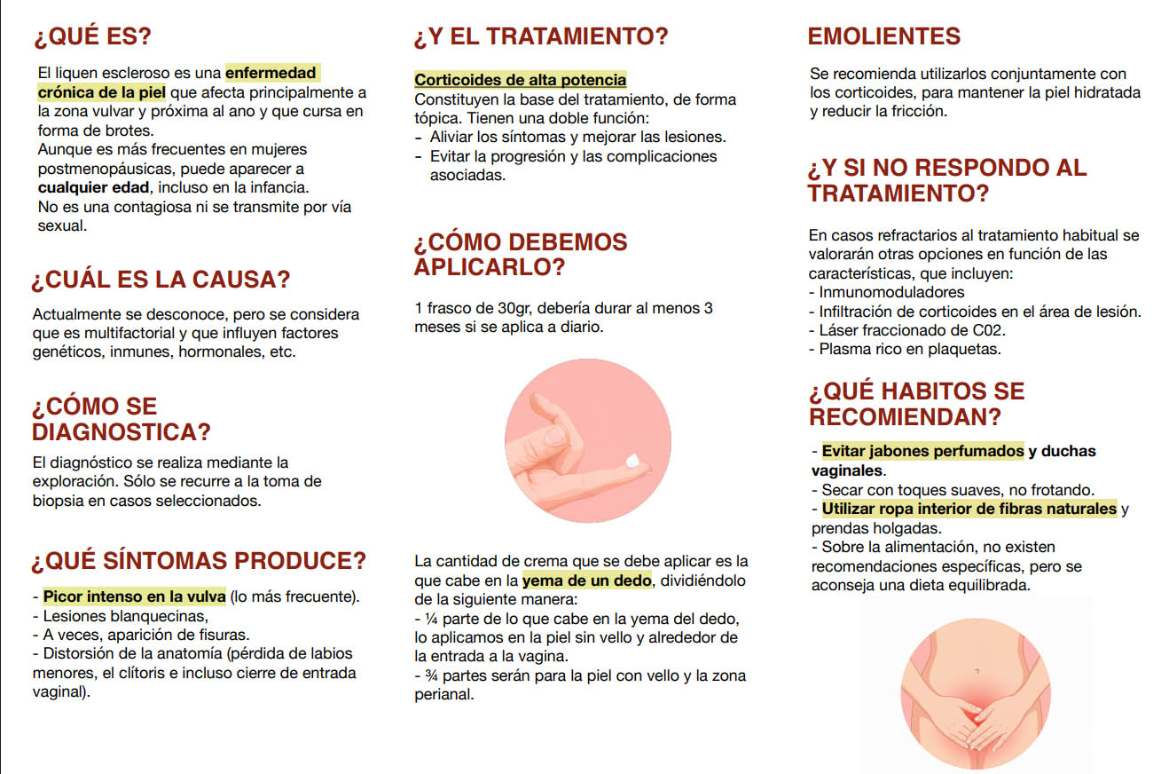 liquen escleroso vulvar 2 liquen escleroso vulvar 2
