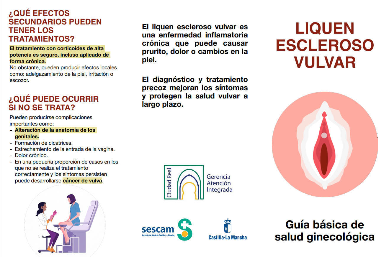liquen escleroso vulvar liquen escleroso vulvar